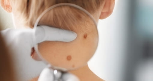 «Болезни кожи: эффективные методы лечения и профилактики»
