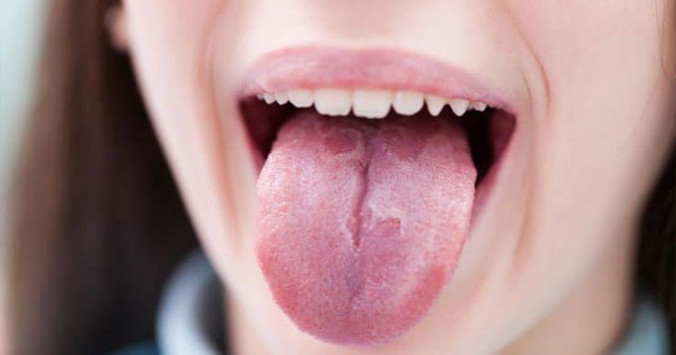 Проблемы в полости рта после орального па