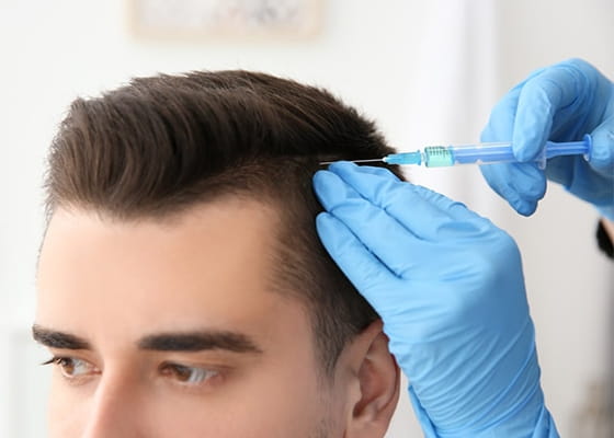 Алопеция: причины, лечение и профилактика выпадения волос