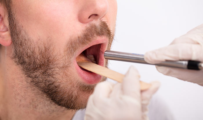 Причины развития рака губы