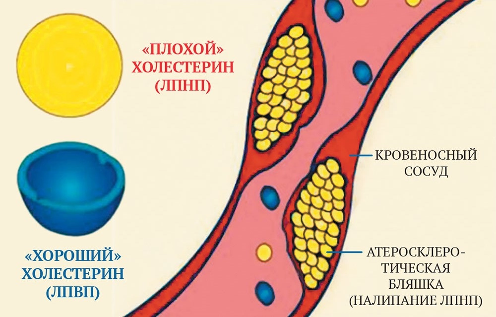 Холестерин: нормальный, низкий и высокий — Медюнион блог